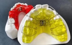 颌骨正畸矫正器