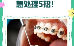 正畸单扎是什么？单颗牙齿矫正的新选择？