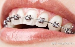 上海矫正牙齿去哪儿好？医院口碑与医生技术怎么选？