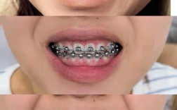 43岁矫正牙齿晚不晚？效果和年轻人差多少？