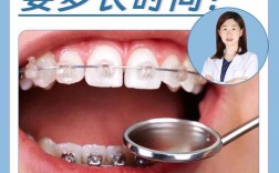 牙齿矫正戴牙套到底要多久？