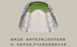 矫正牙齿的斜导是什么？能解决哪些咬合问题？