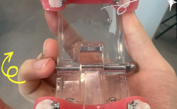 矫正牙齿时舌头太长，会影响矫正效果吗？