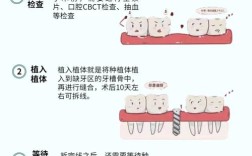 种植牙诊疗过程是怎样的？步骤、时间、疼痛感如何应对？