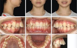 公立专科口腔医院做正畸有哪些独特优势？技术、费用和效果如何与其他机构区分？