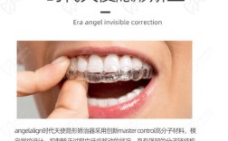 时代天使隐形矫正效果如何？与传统矫正比优势在哪？