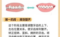 哪些因素会导致牙科正畸？