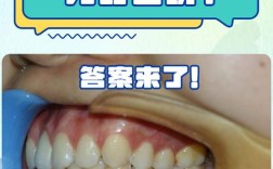 成人矫正牙齿反弹，究竟是什么原因导致的？如何有效避免？