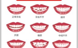 正畸常见的10个问题，你也有这些疑问吗？