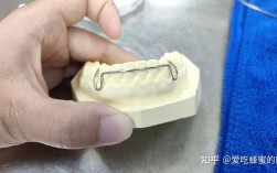 正畸的弓丝有多贵