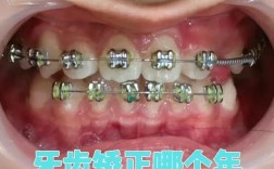 南通牙齿矫正哪家好？求推荐靠谱机构！