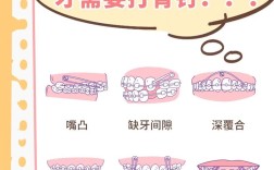 正畸骨钉什么时候需要上？医生如何确定最佳植入时机？