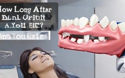 种植牙后一般需要多长时间才能正常吃东西？