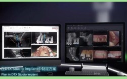 种牙系统有哪些