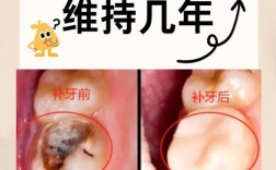 如何有效破坏牙齿菌膜？这些方法真的管用吗？有哪些具体步骤？