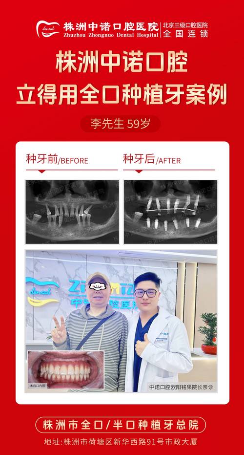 福州种植牙哪个医生好-图2