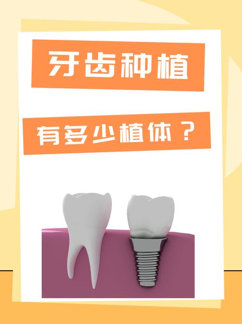 种植牙价格居高不下的原因究竟是什么？技术成本还是材料费用？-图1