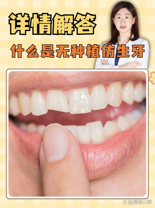 什么叫无种植仿生牙-图1 什么叫无种植仿生牙-图1