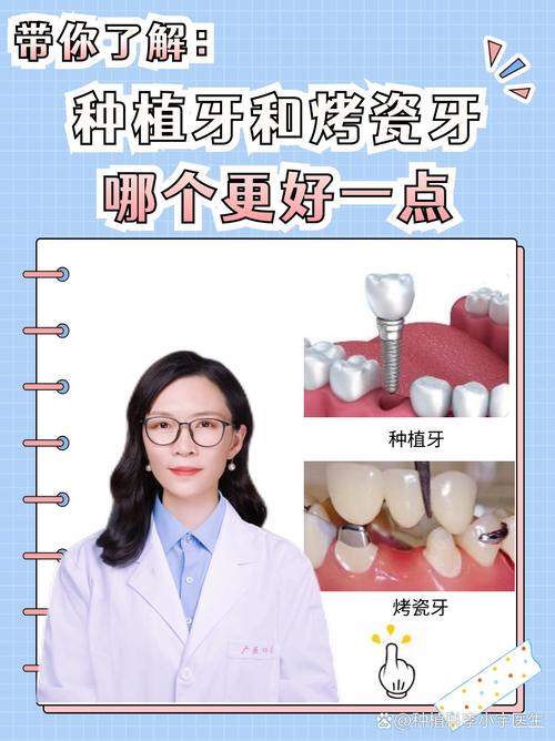 种植牙方式哪种好？如何根据口腔状况选适合的？-图3