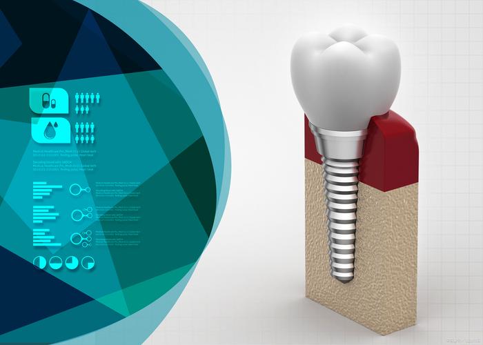 种植牙发臭是怎么回事？如何应对？-图3