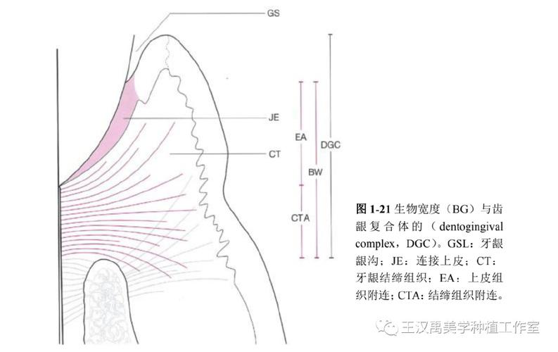种植牙生物学宽度图片能直观展示什么关键信息？-图1