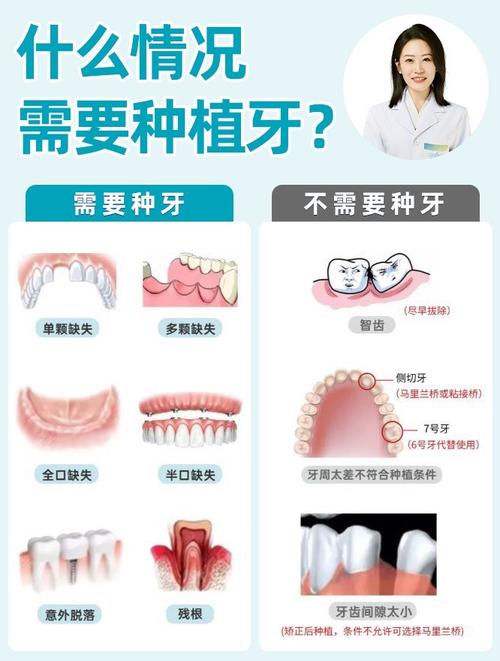 为什么要及时种植牙-图1