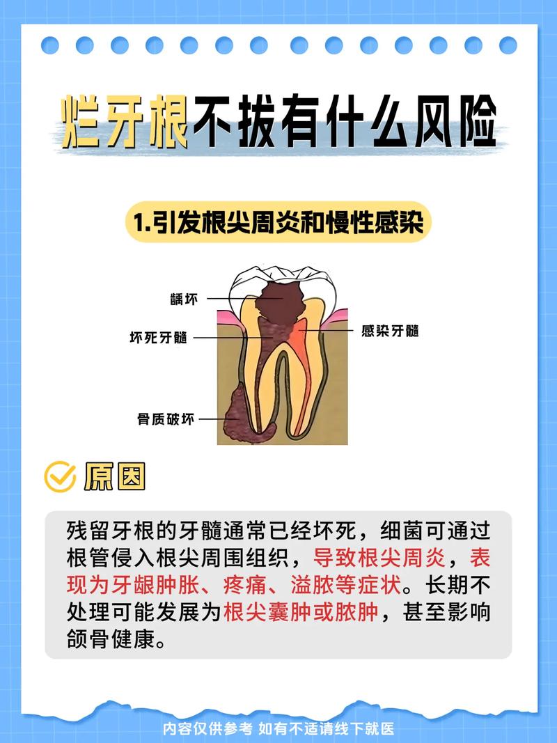 种植牙会有哪些风险？这些隐患如何规避？-图1