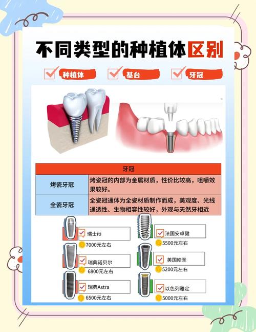 种植牙挑选该注意哪些关键因素?品牌、医生还是技术?-图3 种植牙挑选该注意哪些关键因素?品牌、医生还是技术?-图3