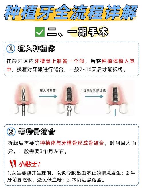 种植牙怎么接诊-图1 种植牙怎么接诊-图1