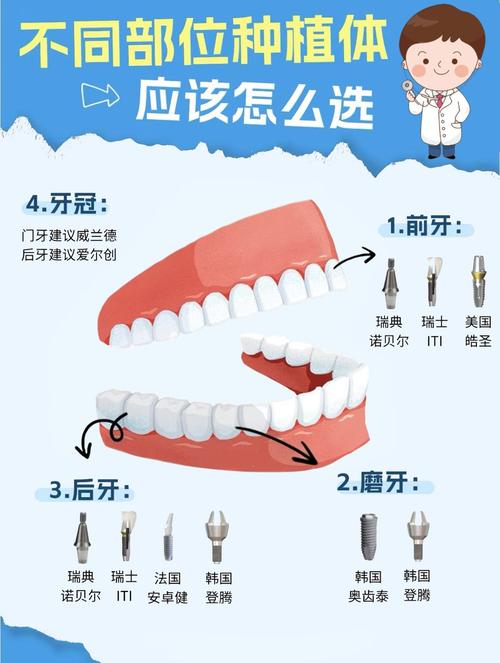 牙齿缺失为何首选种植牙？-图2