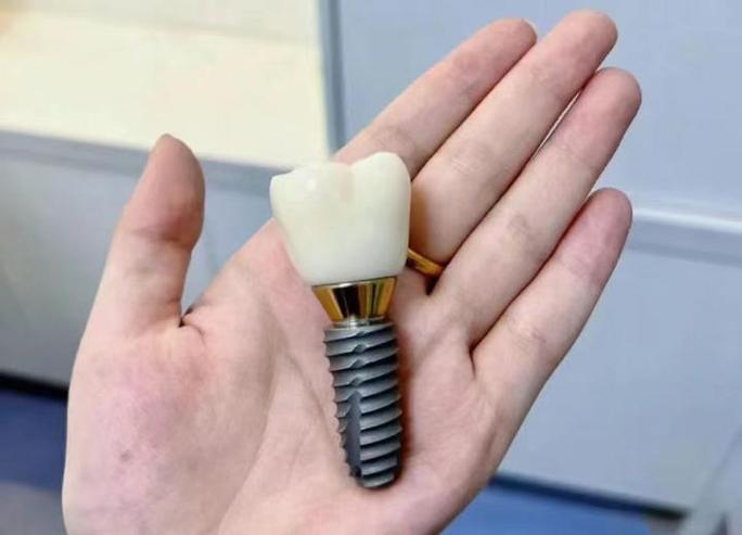 鞍山种植牙价格多少？效果怎么样？医院怎么选才靠谱？要注意什么？-图1