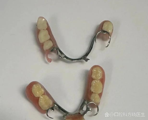 种植牙为何容易食物塞嵌？日常护理要注意什么？-图2