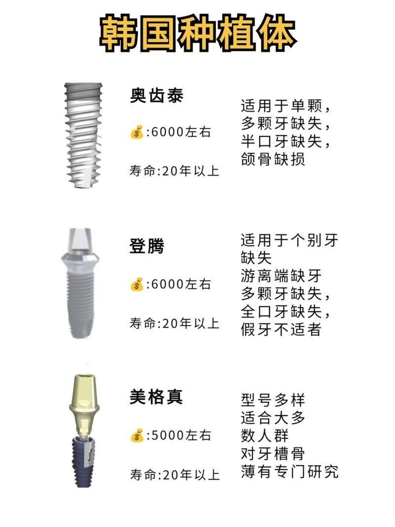 韩国种植牙什么品牌排名-图1 韩国种植牙什么品牌排名-图1