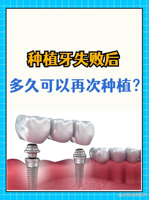 哪些人不适合做种植牙？禁忌人群有哪些？-图2