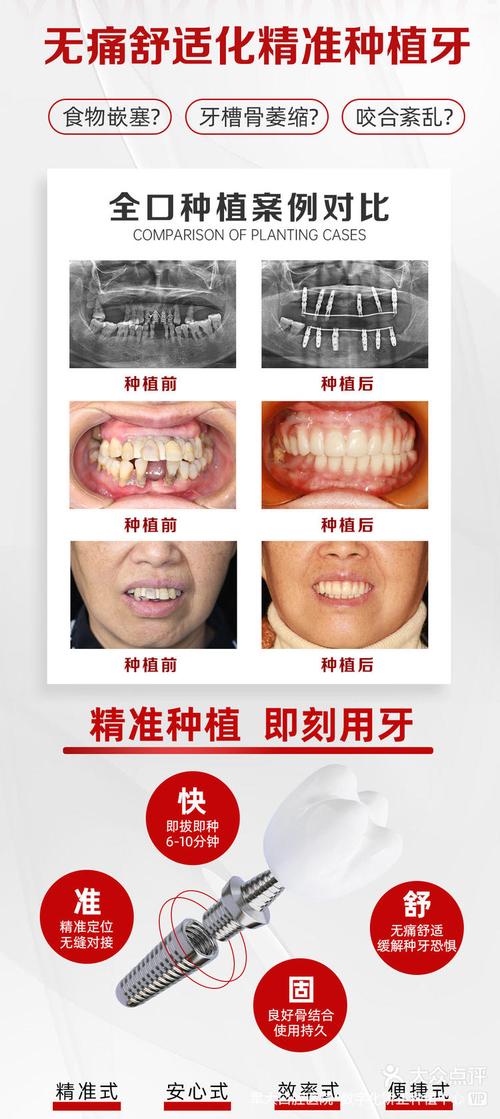 全国种植牙案例库,海量真实案例如何帮患者预见种植效果与风险?-图1 全国种植牙案例库,海量真实案例如何帮患者预见种植效果与风险?-图1