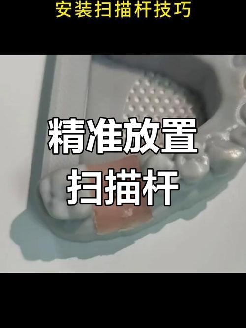 种植牙植入分析杆如何辅助精准种植？-图1