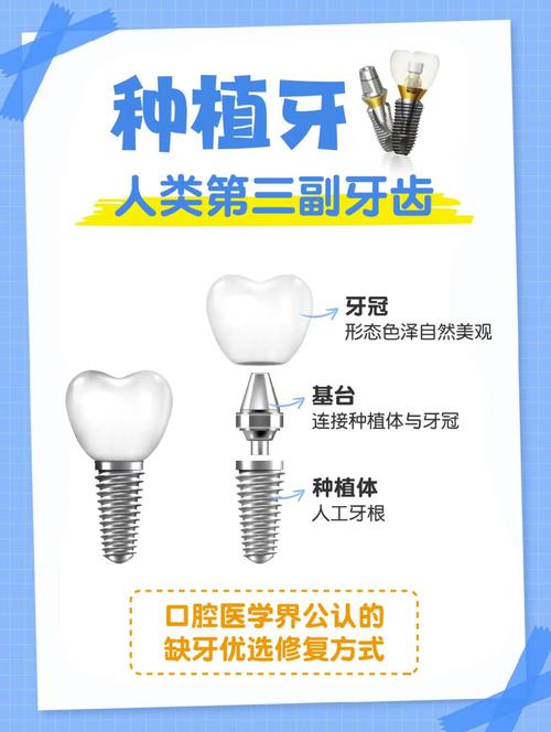 口腔种植牙的优点有哪些?为何成为缺牙修复的理想选择?-图2 口腔种植牙的优点有哪些?为何成为缺牙修复的理想选择?-图2