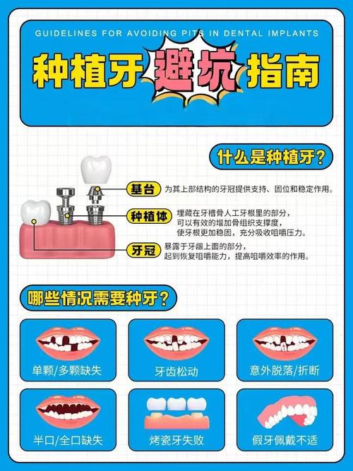 2025种植牙价格会怎样?一颗要花多少钱?-图3 2025种植牙价格会怎样?一颗要花多少钱?-图3
