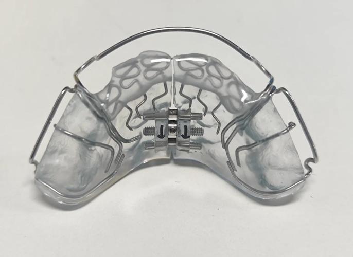 正畸活动矫治器有哪些主要种类？各自适用哪些牙齿问题？-图1