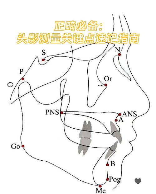正畸头影测量McNamara-图1 正畸头影测量McNamara-图1