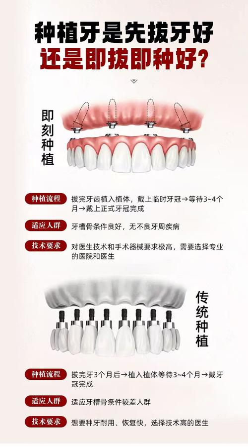半口即刻种植牙种几颗最合适？-图2