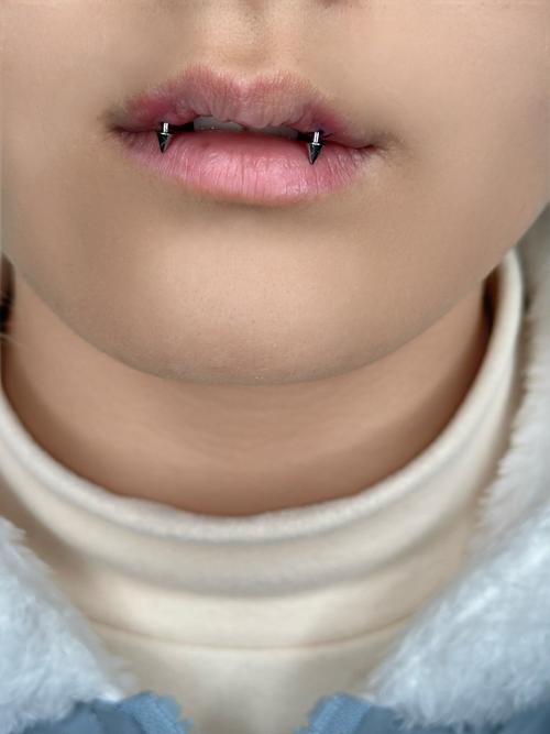 种在牙里面的钉子究竟有多长？-图1