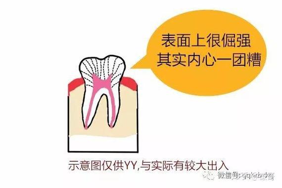 种完牙后多久能喝啤酒？-图3