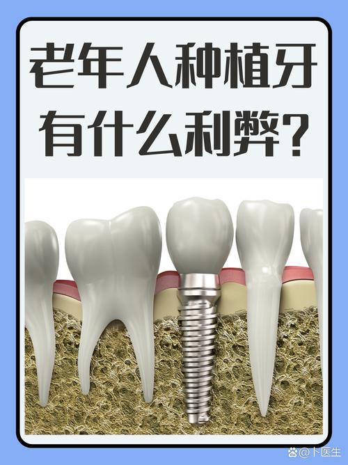 70岁老人最好不要种牙-图1 70岁老人最好不要种牙-图1