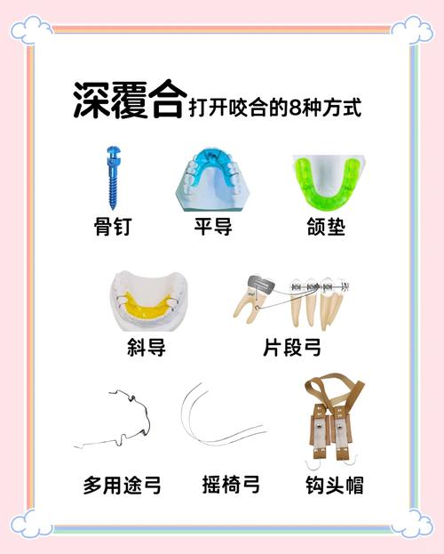 乳前牙反颌的矫治方法主要有哪些？-图2