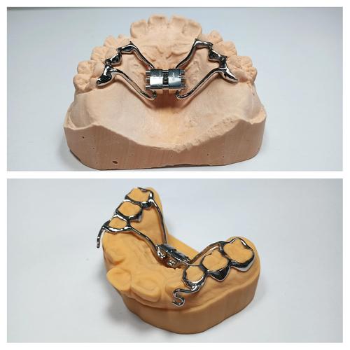 正畸meaw弓的作用是什么?-图1 正畸meaw弓的作用是什么?-图1