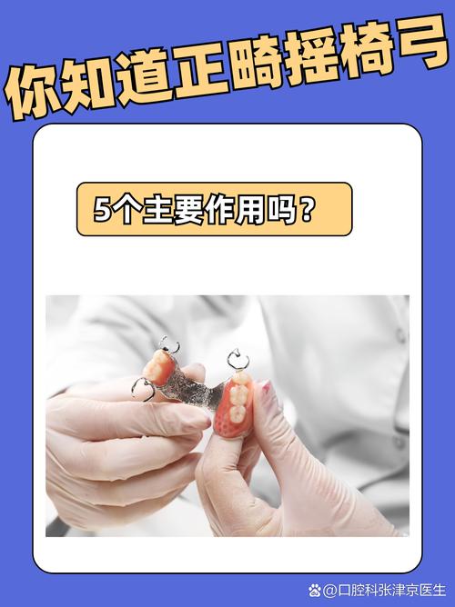 正畸meaw弓的作用是什么?-图2 正畸meaw弓的作用是什么?-图2