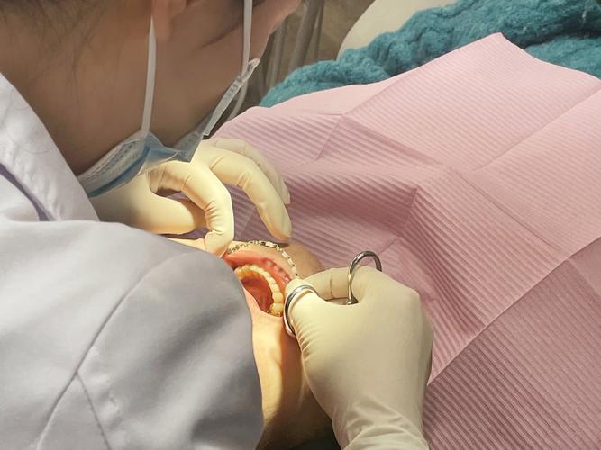 tweed正畸培训班百度云-图2 tweed正畸培训班百度云-图2