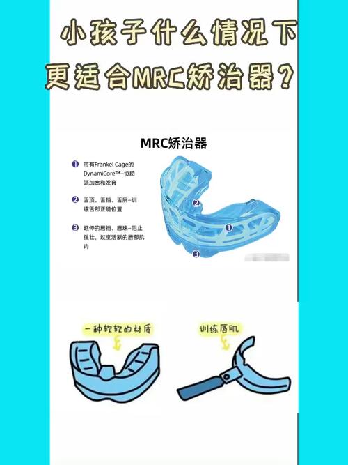 矫正MRC的正确使用方法图具体步骤和方法该如何规范使用？-图3