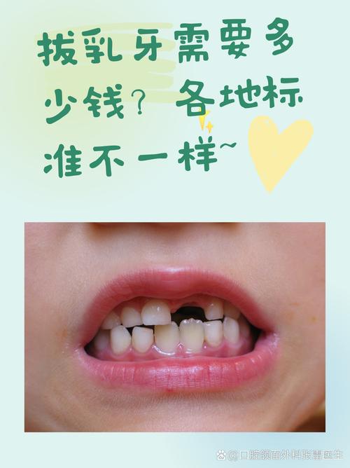 孩子大牙能种牙吗？需满足哪些条件？-图3